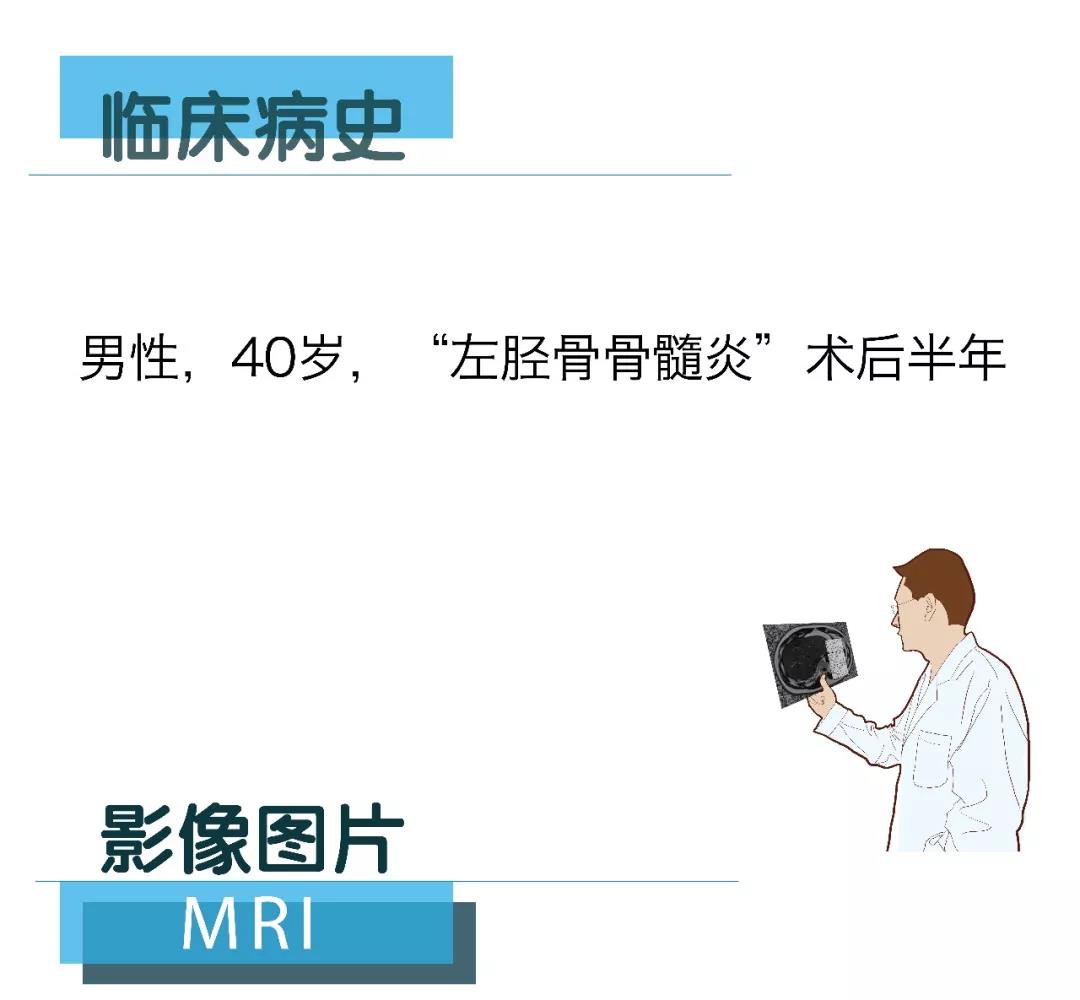 【朗润影像档案】磁共振影像病例分享（编号20180209）